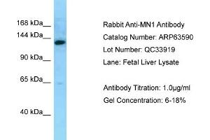 Western Blotting (WB) image for anti-MN1 proto-oncogene (MN1) (C-Term) antibody (ABIN2789559) (Meningioma 1 抗体  (C-Term))