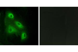 Peptide - +Immunohistochemistry analysis of paraffin-embedded human colon carcinoma tissue, using ES8L3 antibody. (EPS8-Like 3 抗体)