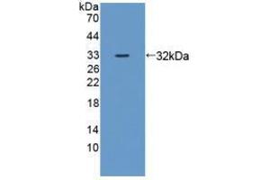 Western blot analysis of recombinant Mouse ZRF1. (DNAJC2 抗体  (AA 368-621))