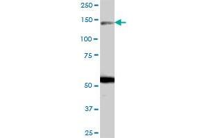 ARHGAP20 MaxPab polyclonal antibody. (ARHGAP20 抗体  (AA 1-1191))