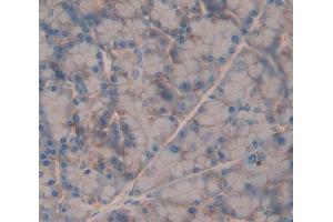 Used in DAB staining on fromalin fixed paraffin- embedded Kidney tissue (GRPR 抗体  (AA 1-114))