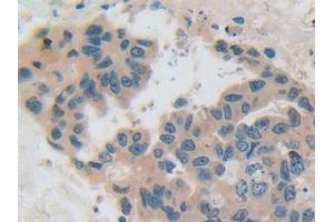 Immunohistochemistry (IHC) image for anti-Casein beta (CSN2) (AA 41-198) antibody (ABIN7436660)