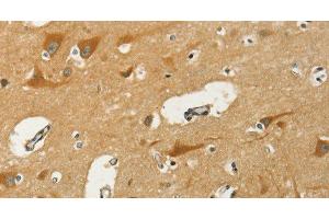 Immunohistochemistry of paraffin-embedded Human brain using KLC1 Polyclonal Antibody at dilution of 1:40 (KLC1 抗体)