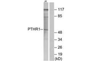 Western blot analysis of extracts from Jurkat cells, using PTHR1 Antibody. (PTH1R 抗体  (AA 145-194))