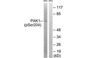 Western blot analysis of extracts from NIH-3T3 cells treated with UV 15', using PAK1 (Phospho-Ser204) Antibody. (PAK1 抗体  (pSer204))