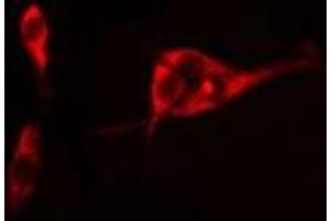 ABIN6275045 staining Hela cells by IF/ICC. (ATG4C 抗体  (N-Term))