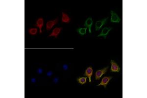 ABIN6258589 and ABIN6275045 staining Hela cells by IF/ICC.