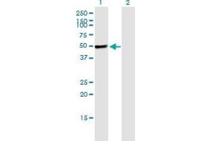 Western Blot analysis of PIK3R1 expression in transfected 293T cell line by PIK3R1 monoclonal antibody (M02), clone 1C10. (PIK3R1 抗体  (AA 1-454))
