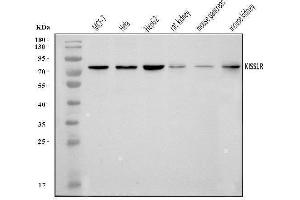 Western blot analysis of GPR54/KISS1R using anti-GPR54/KISS1R antibody (ABIN7602153).