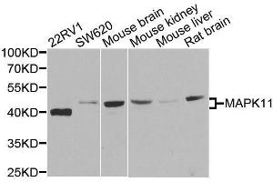 Western blot analysis of extracts of various cell lines, using MAPK11 antibody.
