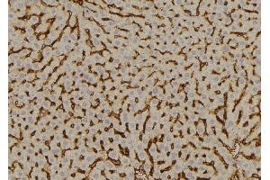 Immunohistochemistry (IHC) image for anti-Sulfotransferase Family, Cytosolic, 2A, Dehydroepiandrosterone (DHEA)-Preferring, Member 1 (SULT2A1) (C-Term) antibody (ABIN6265371)