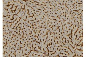ABIN6277613 at 1/100 staining Mouse liver tissue by IHC-P. (SULT2A1 抗体  (C-Term))