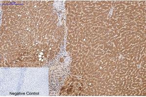 Immunohistochemical analysis of paraffin-embedded human liver tissue. (HSV Tag 抗体)