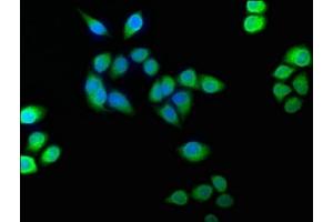 Immunofluorescence staining of Hela cells with ABIN7152961 at 1:100, counter-stained with DAPI. (BLVRB 抗体  (AA 2-206))