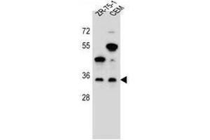 GPM6B Antibody (N-term) western blot analysis in ZR-75-1,CEM cell line lysates (35µg/lane). (GPM6B 抗体  (N-Term))