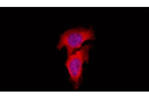 ABIN6262447 and ABIN6266925 staining Hela by IF/ICC. (EIF3L 抗体  (N-Term))