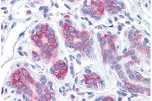 Human Breast: Formalin-Fixed, Paraffin-Embedded (FFPE) (RPS2 抗体  (AA 198-294))