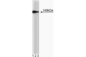 Western blot analysis of AKAP149 on a HeLa cell lysate (Human cervical epitheloid carcinoma, ATCC CCL-2. (AKAP1 抗体  (AA 66-212))