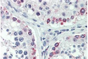Human Testis: Formalin-Fixed, Paraffin-Embedded (FFPE) (HDAC2 抗体  (N-Term))