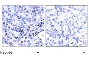 Image no. 1 for anti-Nuclear Factor of kappa Light Polypeptide Gene Enhancer in B-Cells 1 (NFKB1) (Ser337) antibody (ABIN197123) (NFKB1 抗体  (Ser337))