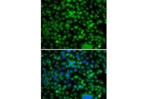 Immunofluorescence analysis of A-549 cells using PHYHD1 antibody (ABIN6133210, ABIN6145585, ABIN6145586 and ABIN6223037). (PHYHD1 抗体  (AA 1-291))