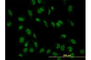 Image no. 2 for anti-TATA Box Binding Protein Associated Factor 11 (TAF11) (AA 158-211) antibody (ABIN598955) (TAF11 抗体  (AA 158-211))