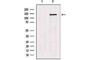 Western Blotting (WB) image for anti-LATS, Large Tumor Suppressor, Homolog 1 (Drosophila) (LATS1) (Internal Region) antibody (ABIN6262920)