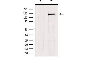 Western blot analysis of extracts from 293, using lats1/2 Antibody.