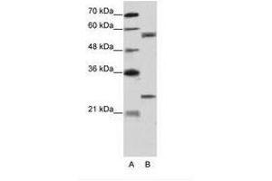 Image no. 2 for anti-Copine I (CPNE1) (AA 75-124) antibody (ABIN203200) (CPNE1 抗体  (AA 75-124))
