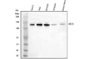 Western blot analysis of OFD1 using anti-OFD1 antibody (ABIN7602739).