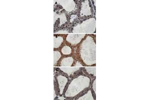 Immunohistochemistry staining of mouse mammary gland samples from lactating mice (L10) with Eif2ak3 polyclonal antibody . (PERK 抗体  (AA 601-1115))