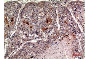 Immunohistochemistry (IHC) image for anti-Tumor Necrosis Factor (Ligand) Superfamily, Member 11 (TNFSF11) (C-Term) antibody (ABIN3187907)