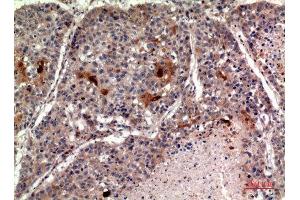 Immunohistochemistry (IHC) analysis of paraffin-embedded Human Lung, antibody was diluted at 1:100. (RANKL 抗体  (C-Term))