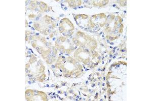 Immunohistochemistry of paraffin-embedded human stomach using OPA3 antibody (ABIN5975243) at dilution of 1/100 (40x lens). (OPA3 抗体)