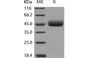 Western Blotting (WB) image for Interleukin 13 Receptor, alpha 2 (IL13RA2) (Active) protein (His tag) (ABIN7320458) (IL13RA2 Protein (His tag))