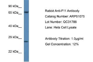 Western Blotting (WB) image for anti-Coagulation Factor XI (F11) (C-Term) antibody (ABIN2788664) (Factor XI 抗体  (C-Term))
