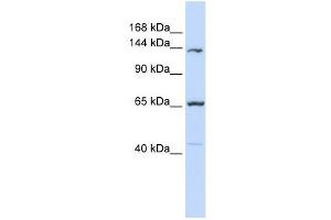 PCDH12 antibody used at 1 ug/ml to detect target protein. (PCDH12 抗体  (Middle Region))