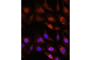 Immunofluorescence (IF) image for anti-Zinc Finger CCCH-Type Containing 12D (ZC3H12D) (AA 150-230) antibody (ABIN7271448)