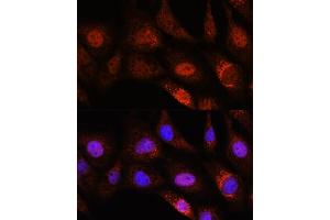 Immunofluorescence analysis of NIH/3T3 cells using ZC3H12D Rabbit pAb (ABIN7271448) at dilution of 1:100. (ZC3H12D 抗体  (AA 150-230))
