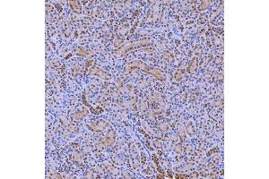 IHC analysis of SNRNP200 using anti-SNRNP200 antibody (ABIN7602032). (SNRNP200 抗体  (AA 557-2129))