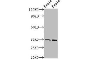 Western Blot Positive WB detected in: Mouse brain tissue, Rat brain tissue All lanes: FOXE3 antibody at 4 μg/mL Secondary Goat polyclonal to rabbit IgG at 1/50000 dilution Predicted band size: 34 kDa Observed band size: 34 kDa (FOXE3 抗体  (AA 4-74))