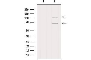 Western blot analysis of extracts from Mouse lung, using FAM65B Antibody. (FAM65B 抗体)