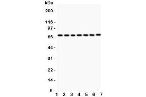 Western blot testing of FOXO3A antibody and Lane 1:  rat thymus;  2: (r) NRK;  3: (r) PC12;  4: human HEPG2;  5: (h) HeLa;  6: (h) K562;  7: (h) Jurkat.