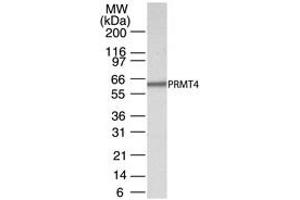 Western Blotting (WB) image for anti-Coactivator-Associated Arginine Methyltransferase 1 (CARM1) (AA 45-69) antibody (ABIN208355) (CARM1 抗体  (AA 45-69))
