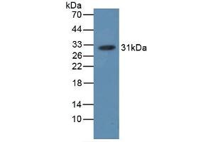 Detection of HB in HB, Simian using Polyclonal Antibody to Hemoglobin (HB) (Hemoglobin 抗体)