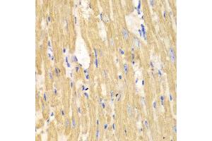 Immunohistochemistry of paraffin-embedded mouse heart using CAPN1 antibody at dilution of 1:100 (400x lens). (CAPNL1 抗体)