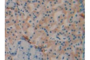 Detection of DBP in Rat Pancreas Tissue using Monoclonal Antibody to Vitamin D Binding Protein (DBP) (Vitamin D-Binding Protein 抗体  (AA 209-394))