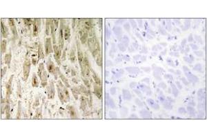 Immunohistochemistry analysis of paraffin-embedded human heart tissue, using Smad1 (Ab-465) Antibody.