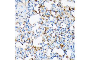 Immunohistochemistry of paraffin-embedded rat lung using Alpha-2-Macroglobulin (Alpha-2-Macroglobulin (M)) Rabbit mAb (ABIN7265558) at dilution of 1:100 (40x lens). (alpha 2 Macroglobulin 抗体)