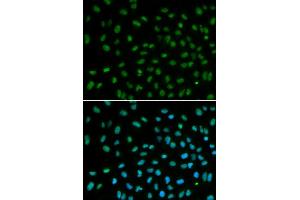 Immunofluorescence analysis of MCF7 cell using DDB2 antibody. (DDB2 抗体)